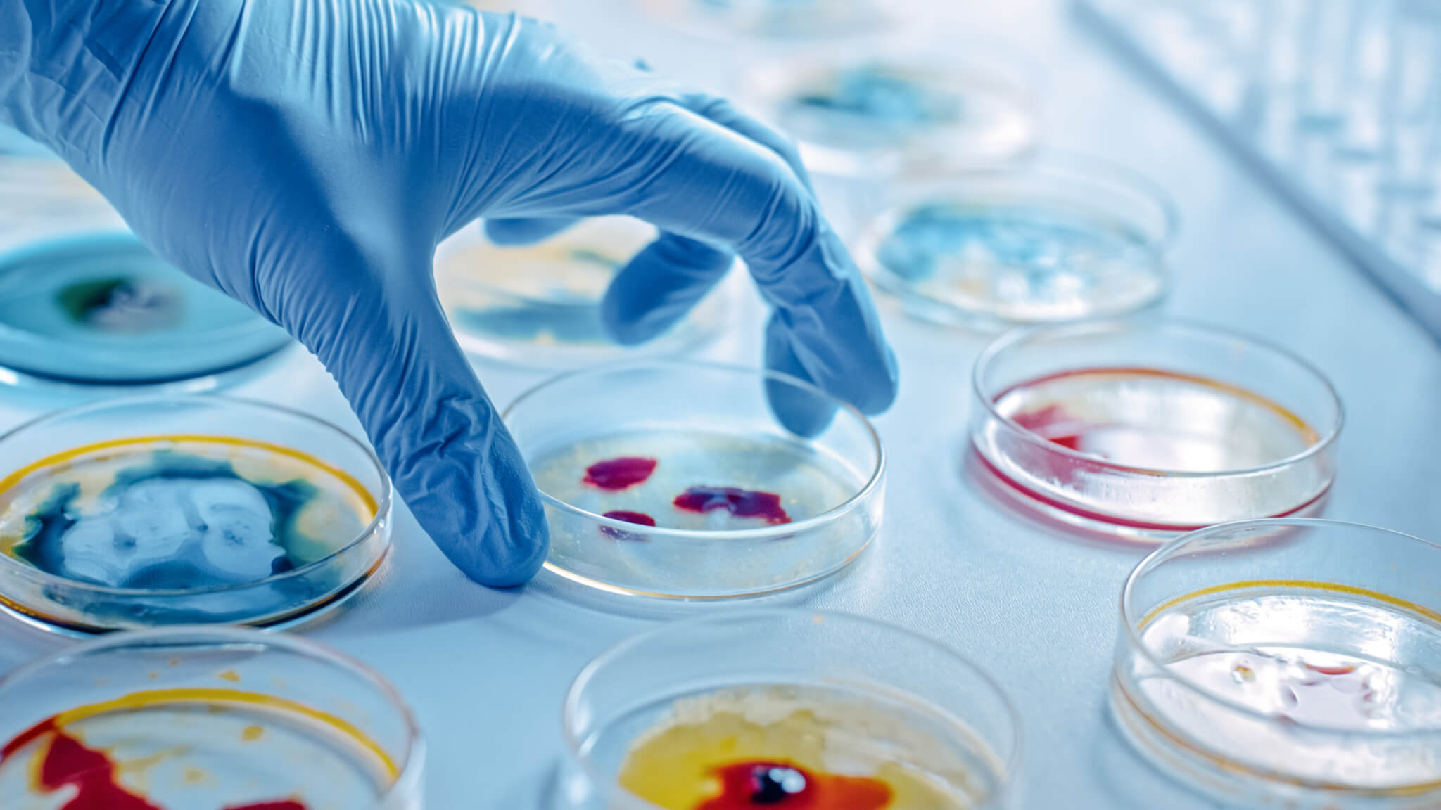 Scientist,Works,With,Petri,Dishes,With,Various,Bacteria,,Tissue,And